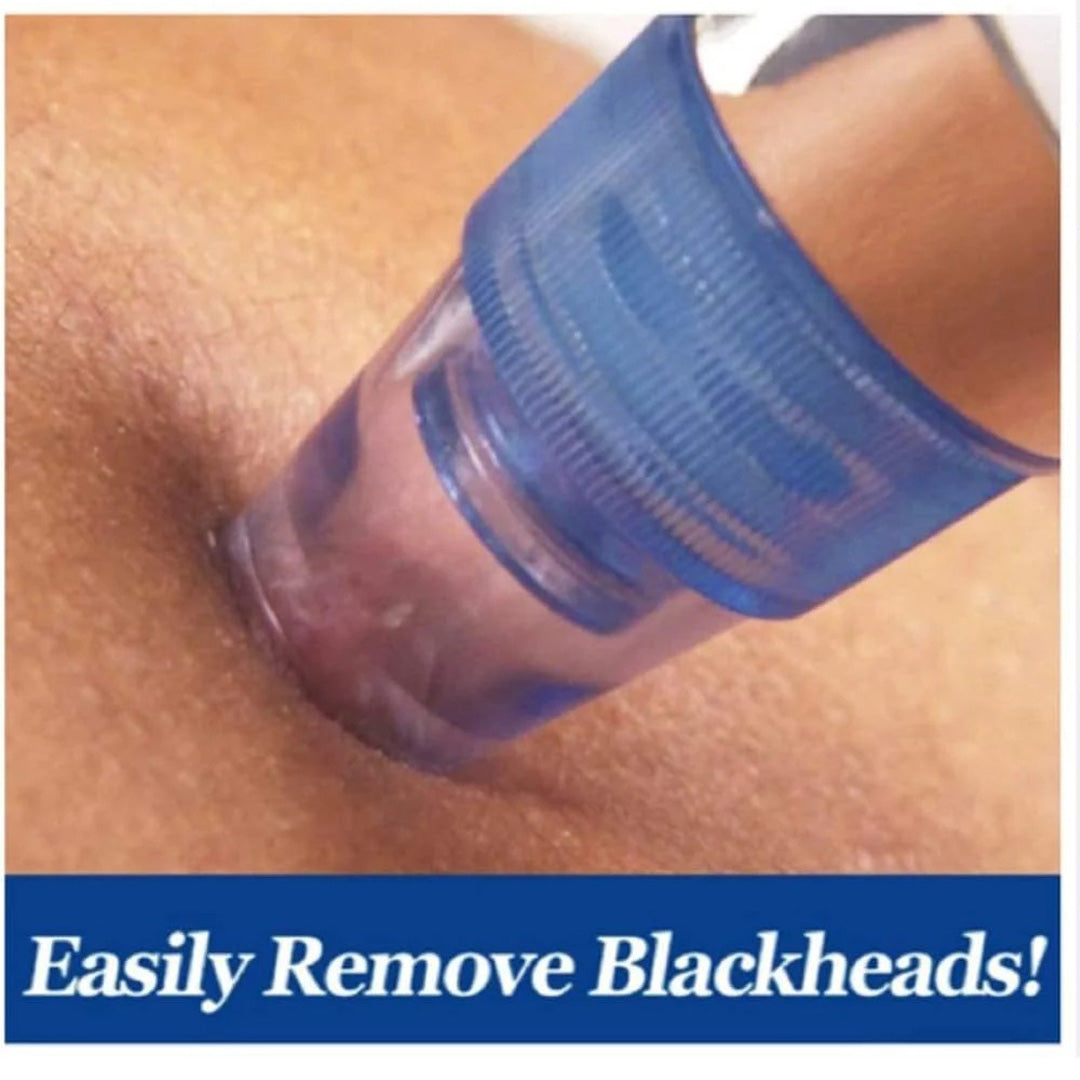Blackhead Remover Pore Vacuum Electric Facial Cleaner with 5 Suction Levels