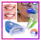 Ultimate tooth whitening system for professional bright smile care