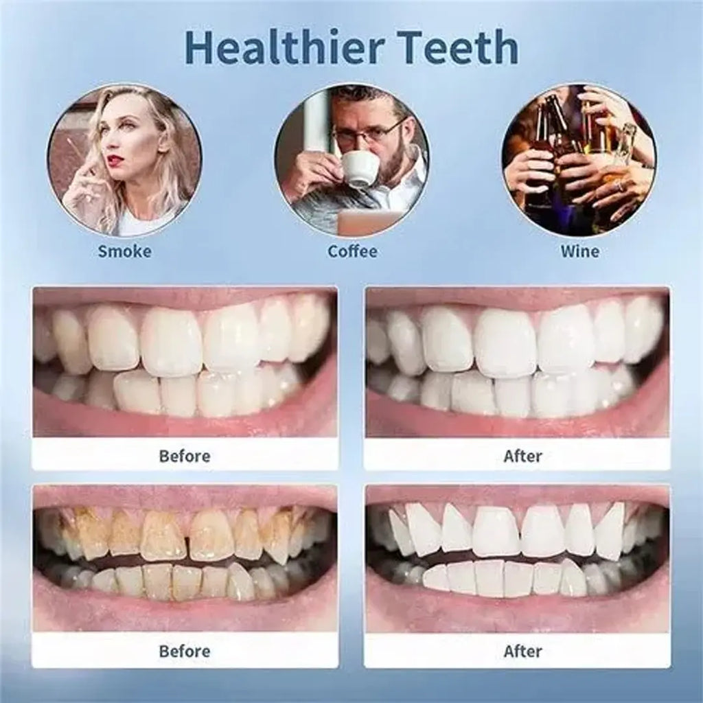 Smart ultra sonic teeth cleaner for advanced electric dental care