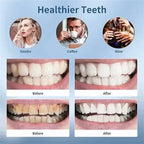 Smart ultra sonic teeth cleaner for advanced electric dental care