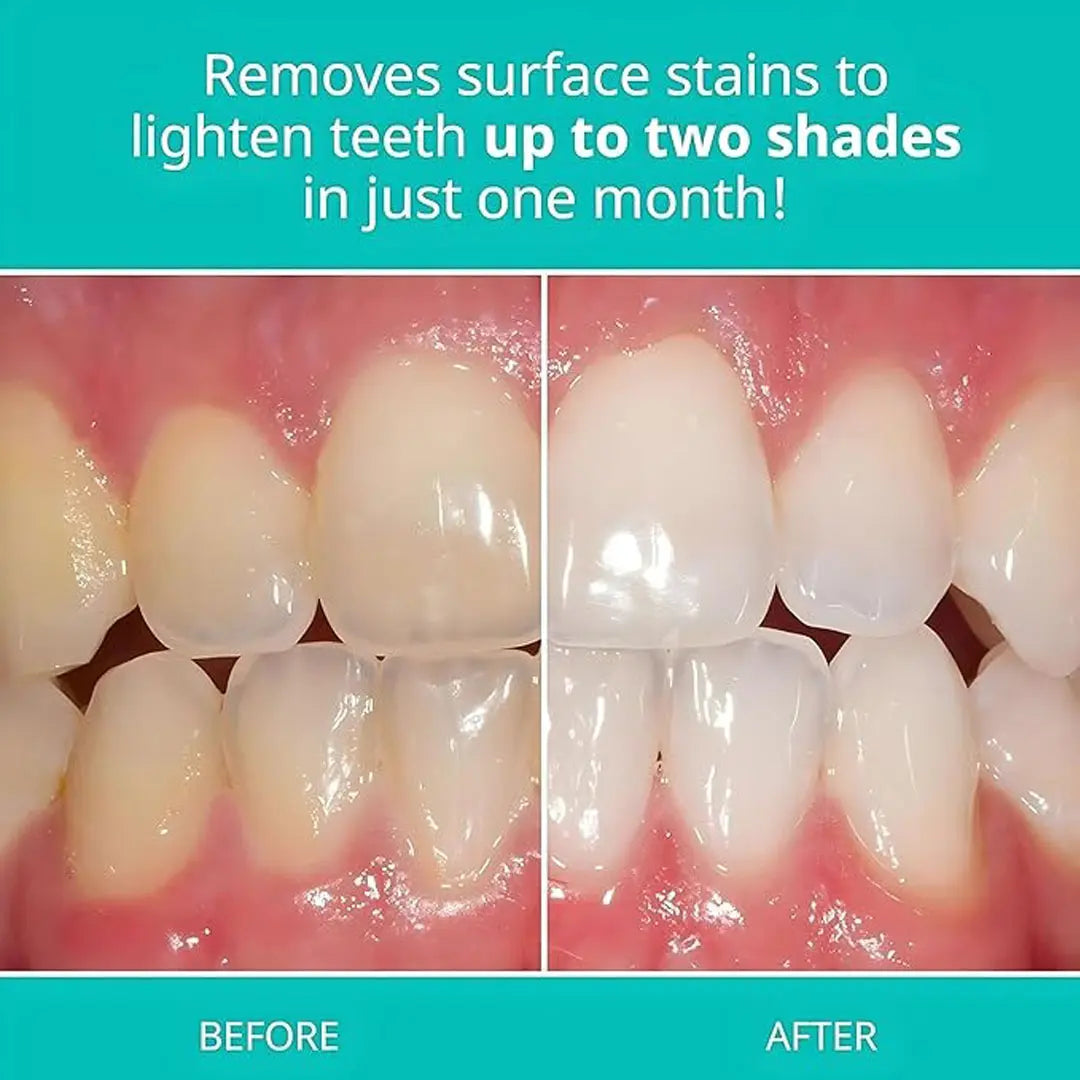Opalescence whitening toothpaste with cool mint fluoride for whiter teeth