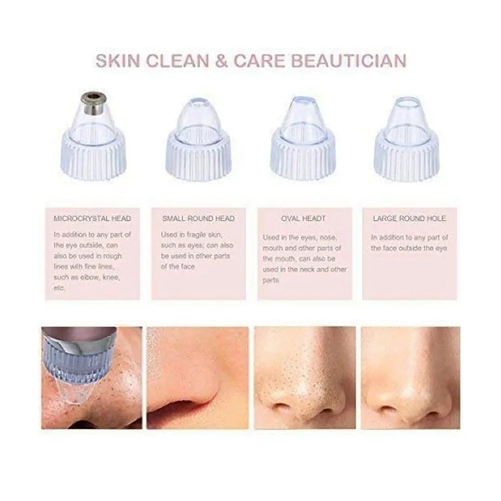 Rechargeable pore vacuum device for deep cleansing and smoother skin