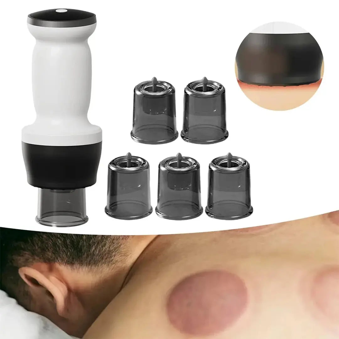 Smart cupping therapy device designed for deep muscle relief and comfort