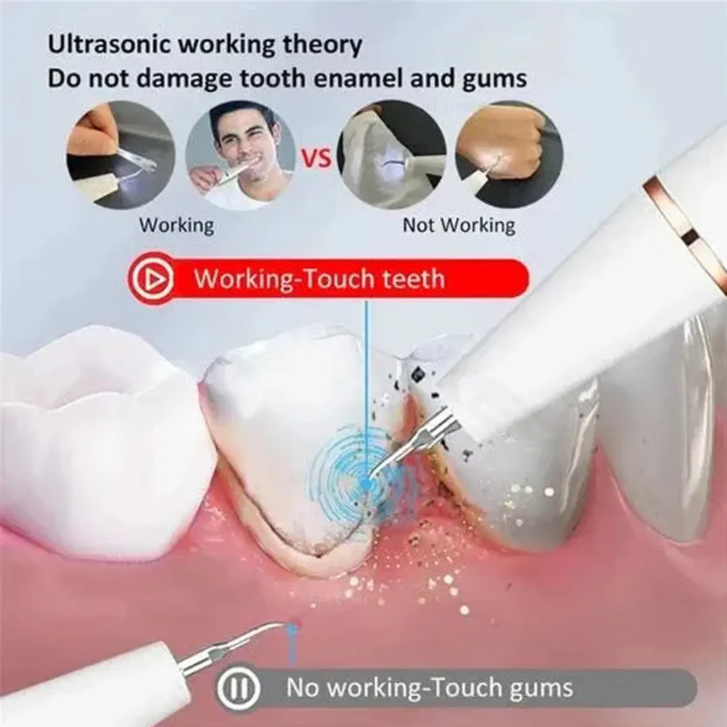 Professional dental cleaning device for healthier teeth at home