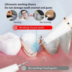 Smart Ultra-Sonic Teeth Cleaner Electric Dental Cleaning Tool